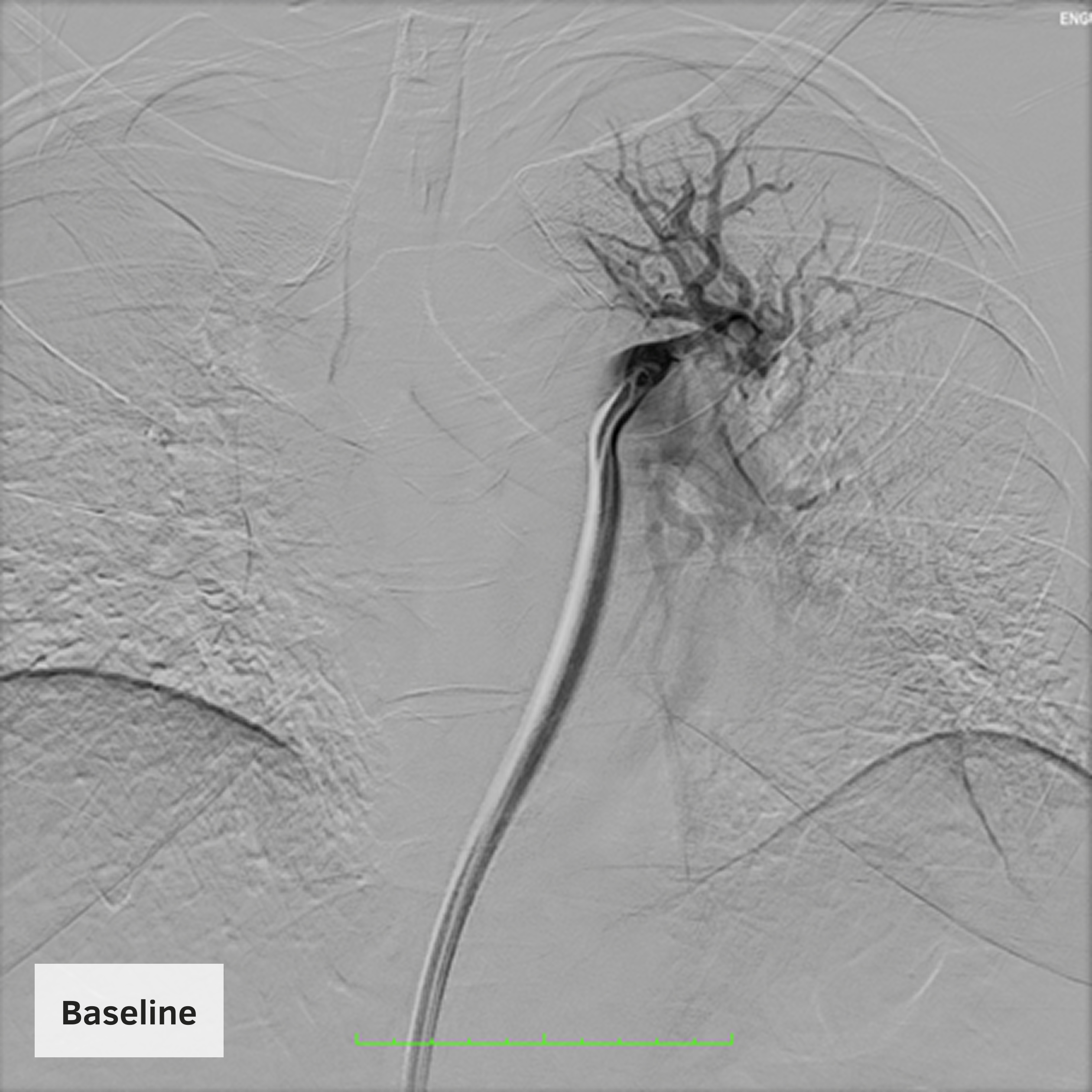 E2-Clinical-Page-Case-Outcome-Baseline