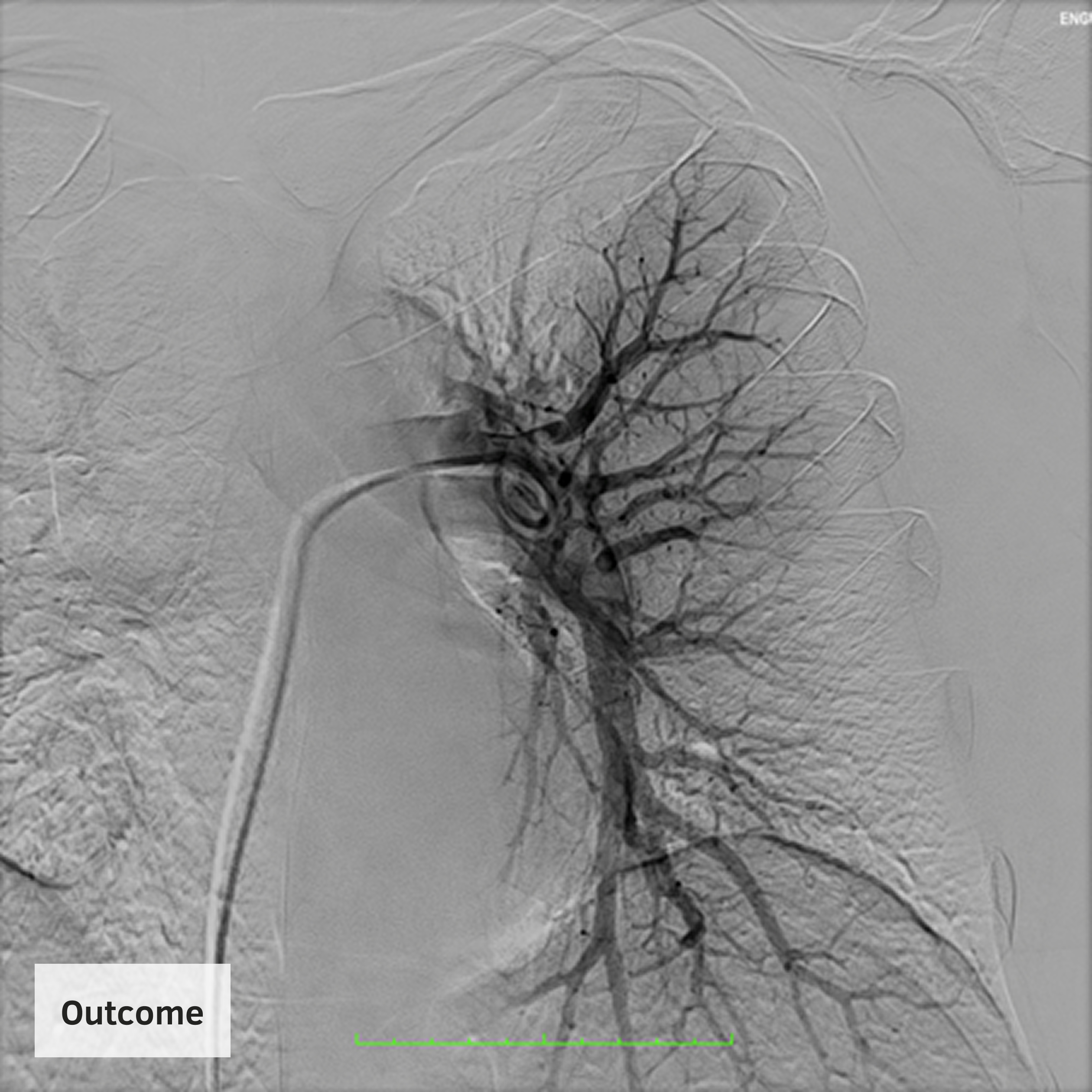 E2-Clinical-Page-Case-Outcome-Outcome